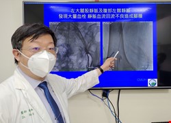 施打疫苗會造成靜脈血栓？該如何處理？接種後應注意的事